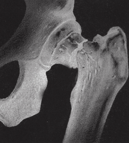 Prise en charge de ostéodensitométrie